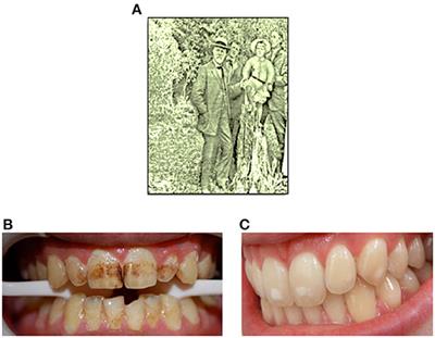 Revisiting Fluoride in the Twenty-First Century: Safety and Efficacy Considerations